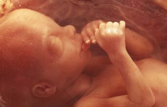 Is It Possible to Test for Autism in the Womb? Test for Autism in the Womb