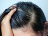 Everyday Hacks for Oily Scalp Oily Scalp