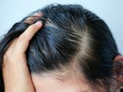 Everyday Hacks for Oily Scalp Oily Scalp