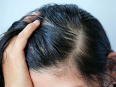 Everyday Hacks for Oily Scalp Oily Scalp