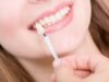 Various Types of Veneers: A Helpful Guide to Make the Wisest Decision Veneers
