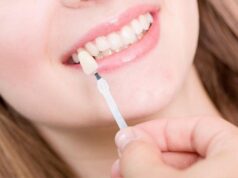Various Types of Veneers: A Helpful Guide to Make the Wisest Decision Veneers